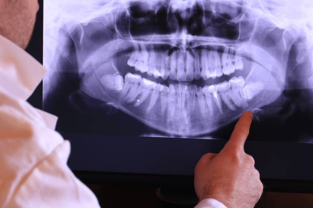 Best Emergency Dentist for Knocked-Out Tooth in Macon, IL