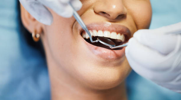 Best Emergency Cosmetic Dentistry in Macon, IL