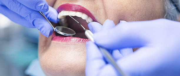 Best Emergency Cosmetic Dentistry in Macon, IL